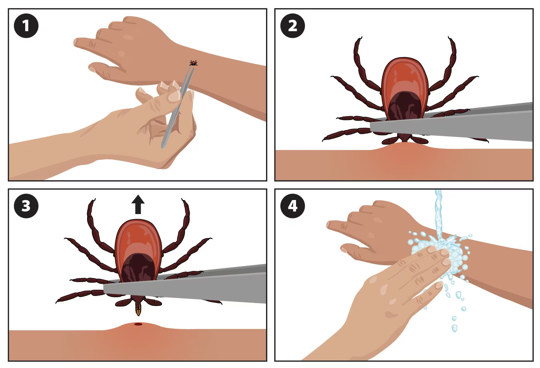 Tick Removal_CDC.png
